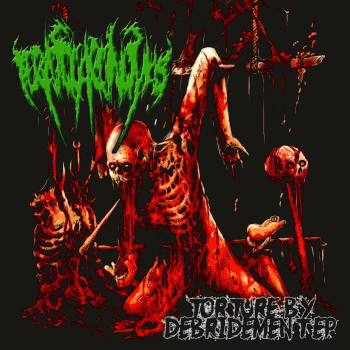 Teratocarcinomas : Torture by Debridement